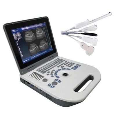 جودة  TGC Control Notebook Ultrasound Scanner For Pregnancy Home Use مصنع