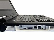 جهاز الموجات فوق الصوتية المحمول الملون بشاشة LED مقاس 15 بوصة مع زاوية مسح 60 درجة ومسبار تكوين 2.0 ميجاهرتز - 5.0 ميجاهرتز