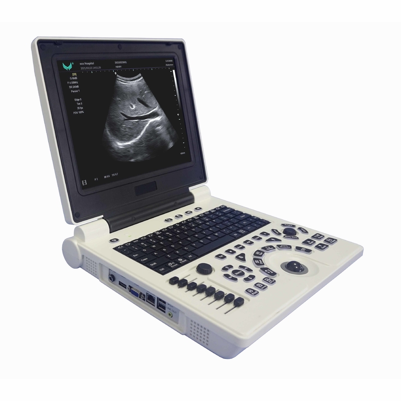 جهاز الموجات فوق الصوتية دوبلر الملون المحمول OB GYN أثناء الحمل