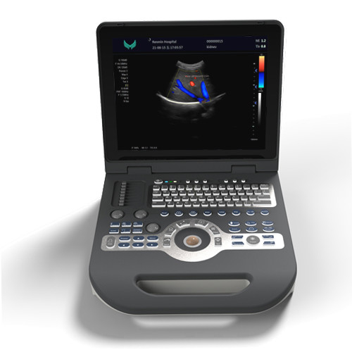 SGS Cardiology Color Ultrasound Scanner 220V جهاز الموجات فوق الصوتية دوبلر المحمولة