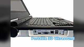 المستشفى السريري المحمول بالموجات فوق الصوتية E20