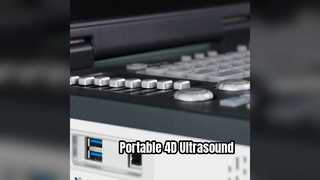 جهاز الموجات فوق الصوتية دوبلر رباعي الأبعاد المحمول جاهز لوحدة العناية المركزة