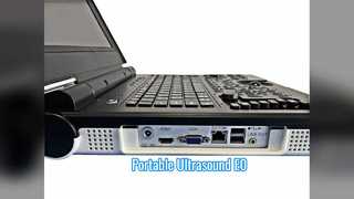 مسح المسالك البولية بالموجات فوق الصوتية دوبلر الملون المحمول E0